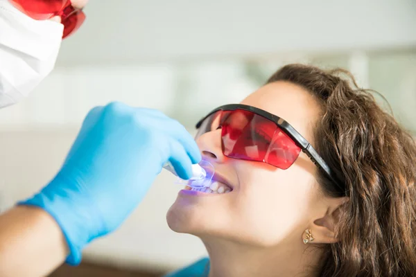Teeth Bleaching
